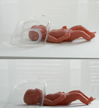 Neonatal Oxygen Mask